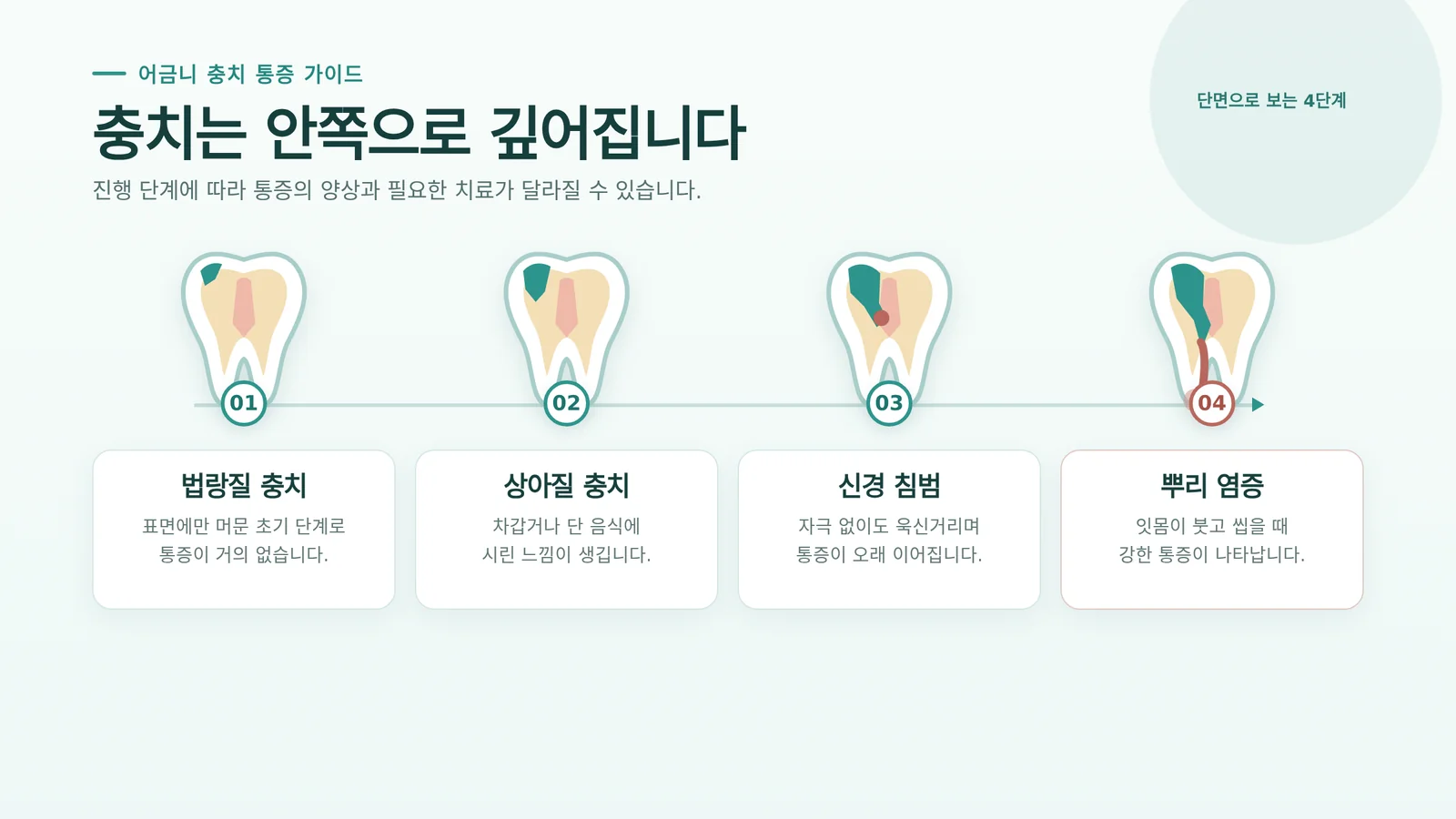 충치 진행 단계 도해